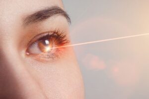 How Lasers Are Used During LASIK featured image